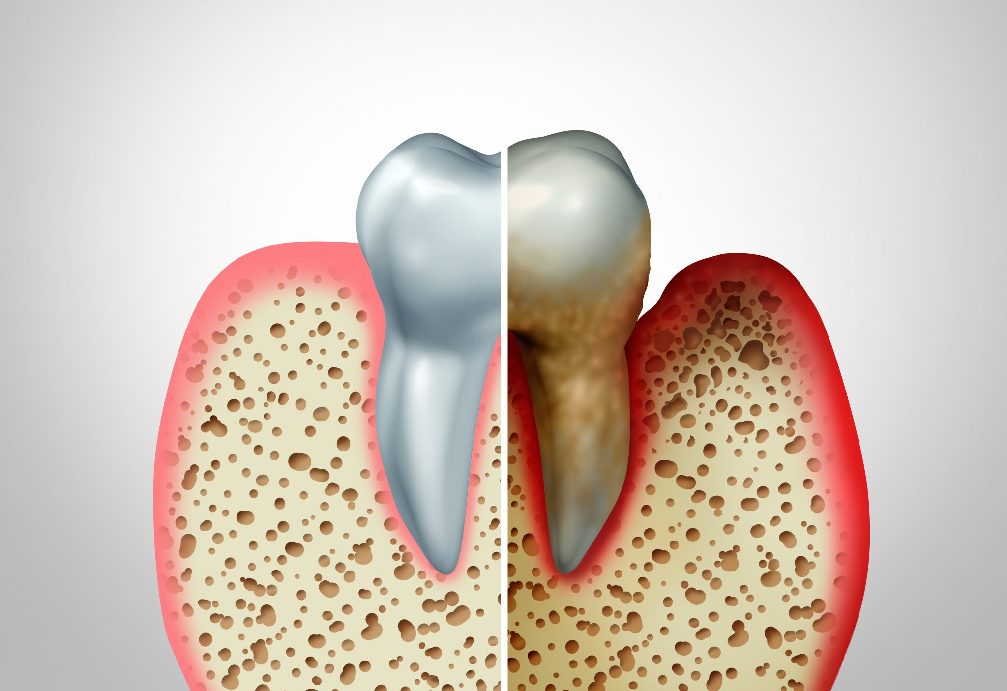 Periodontal health and overall health