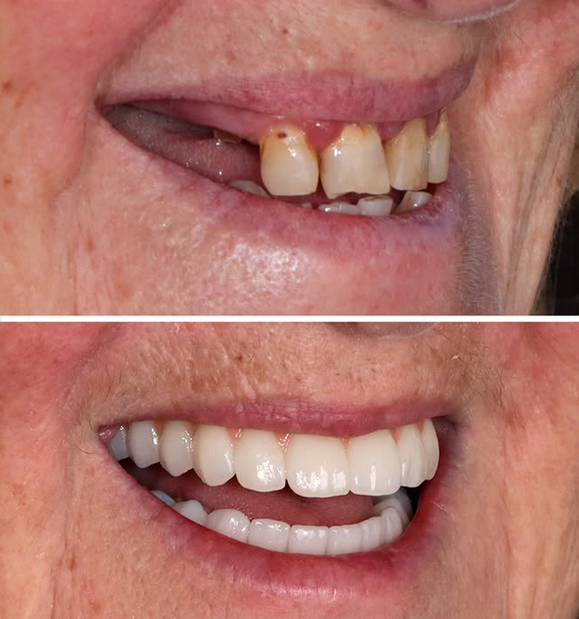 Success Case 6 - Mejora Estética y Soporte Facial
