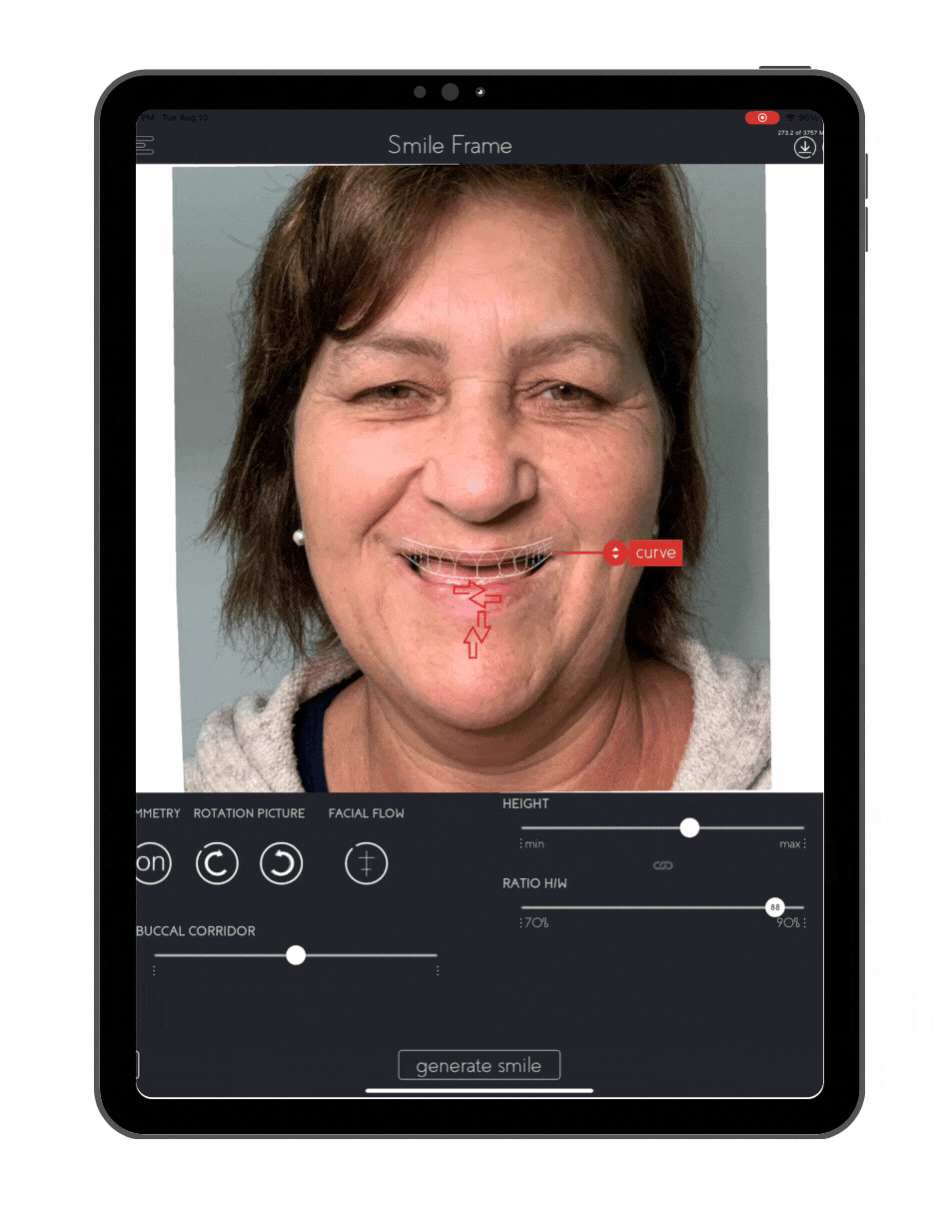 Animated GIF showing a smile transformation process.